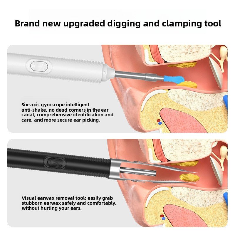 Smart Visual Ear Cleaning Kit with WiFi Connectivity - DoubleJoy Store